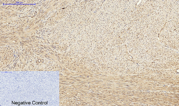 PKC Polyclonal Antibody