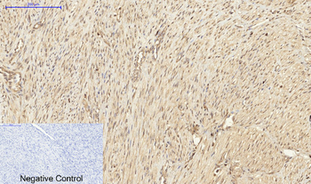 PKC Polyclonal Antibody