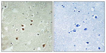 PDRG1 Polyclonal Antibody