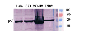 p53 Polyclonal Antibody