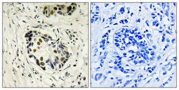 p53 Polyclonal Antibody