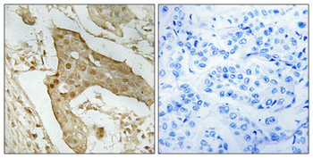 p53 Polyclonal Antibody