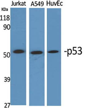 p53 Polyclonal Antibody