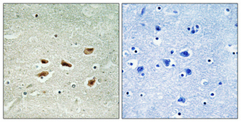 p39 Polyclonal Antibody