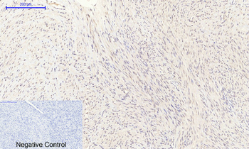 NOS3 Polyclonal Antibody