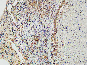 Nibrin Polyclonal Antibody