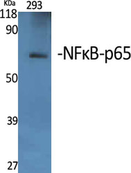 NFκB-p65 Polyclonal Antibody