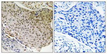 NFκB-p65 Polyclonal Antibody