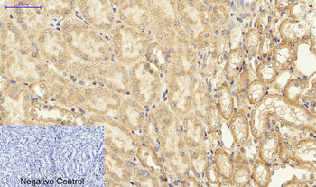 NFκB-p65 Polyclonal Antibody