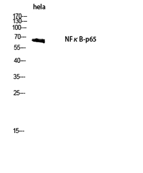 NFκB-p65 Polyclonal Antibody
