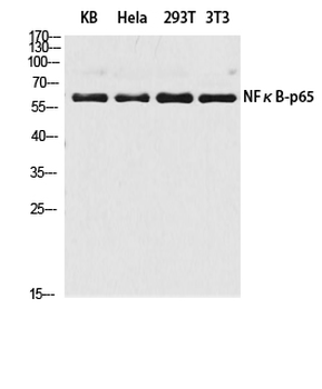NFκB-p65 Polyclonal Antibody