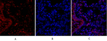 NFκB-p105/p50 Polyclonal Antibody