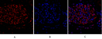 NFκB-p105/p50 Polyclonal Antibody