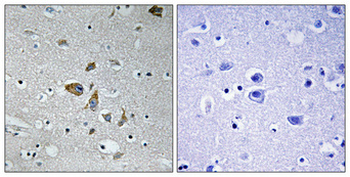 NDUFA4 Polyclonal Antibody