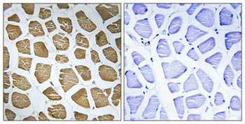 MRP-S22 Polyclonal Antibody