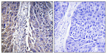 MRP-L15 Polyclonal Antibody