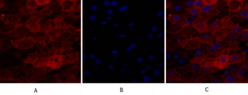 Lamin A/C Polyclonal Antibody