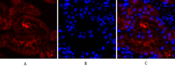 Lamin A/C Polyclonal Antibody