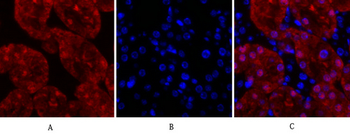 Lamin A/C Polyclonal Antibody