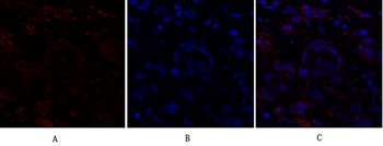 Ki-67 Polyclonal Antibody