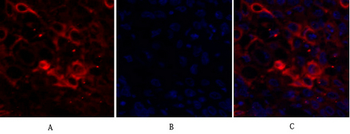 Ki-67 Polyclonal Antibody