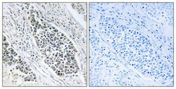 KDEL Receptor 2 Polyclonal Antibody