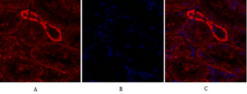 IRS-1 Polyclonal Antibody
