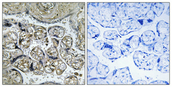 INSL4 Polyclonal Antibody