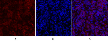 IGF-IR Polyclonal Antibody
