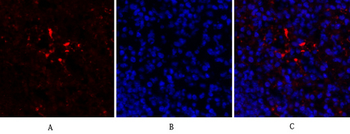 HIF-1α Polyclonal Antibody