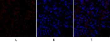 GSK3β Polyclonal Antibody