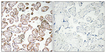 GCSm-γ Polyclonal Antibody