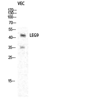 Galectin-9 Polyclonal Antibody