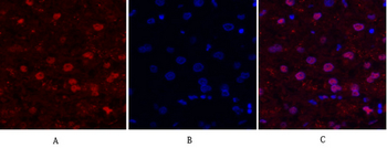FAK Polyclonal Antibody