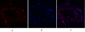 FAK Polyclonal Antibody