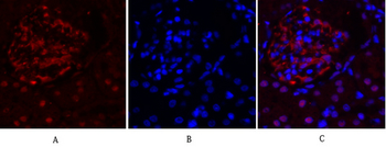 FAK Polyclonal Antibody