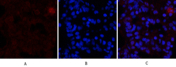 ERα Polyclonal Antibody