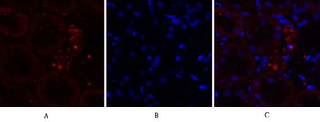 EGFR Polyclonal Antibody