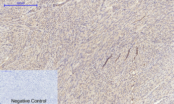EGFR Polyclonal Antibody