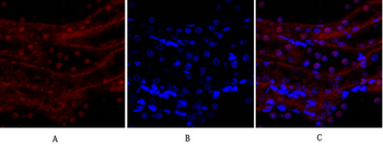 E-cadherin Polyclonal Antibody
