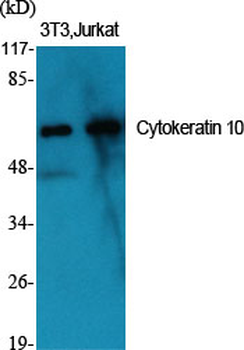 Cytokeratin 10 Polyclonal Antibody