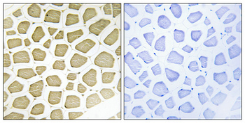 CYP7B1 Polyclonal Antibody
