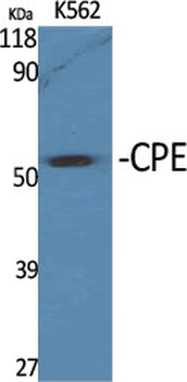 CPE Polyclonal Antibody