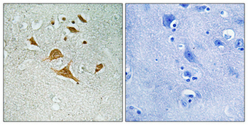CDK5 Activator-binding C42 Polyclonal Antibody
