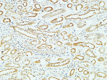 CD83 Polyclonal Antibody