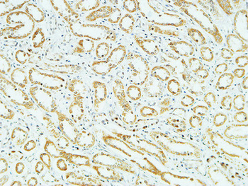 CD83 Polyclonal Antibody