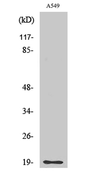 CD3-δ Polyclonal Antibody