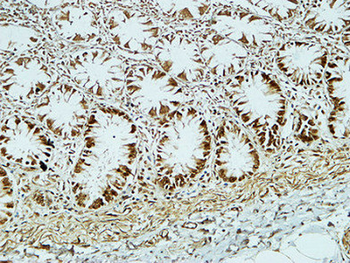 CD34 Polyclonal Antibody