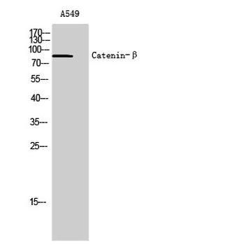 Catenin-β Polyclonal Antibody