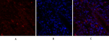 BRCA1 Polyclonal Antibody